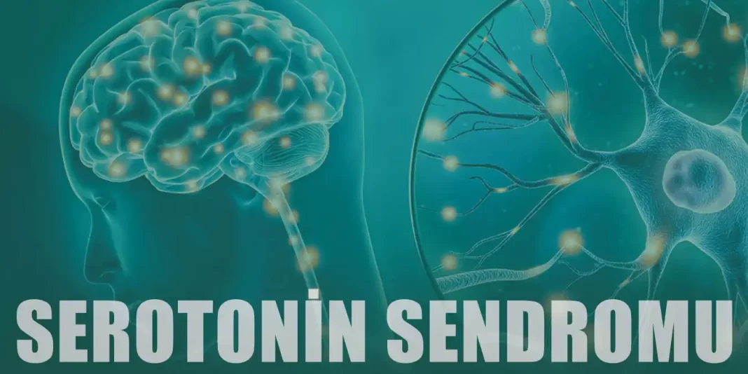 Serotonin Sendromu Nedir? | Aşırı Seretonin Belirtileri
